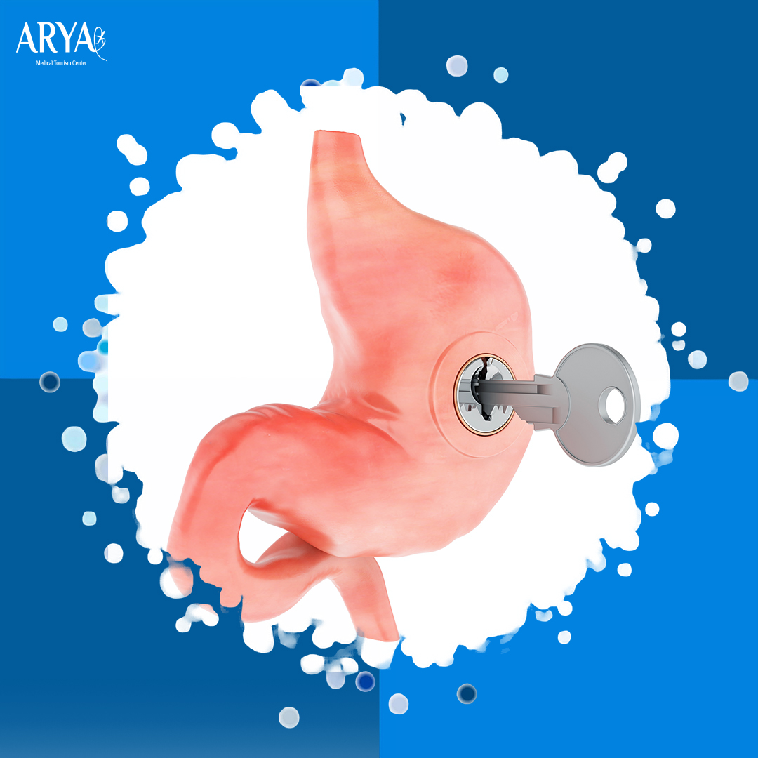 تكميم المعدة